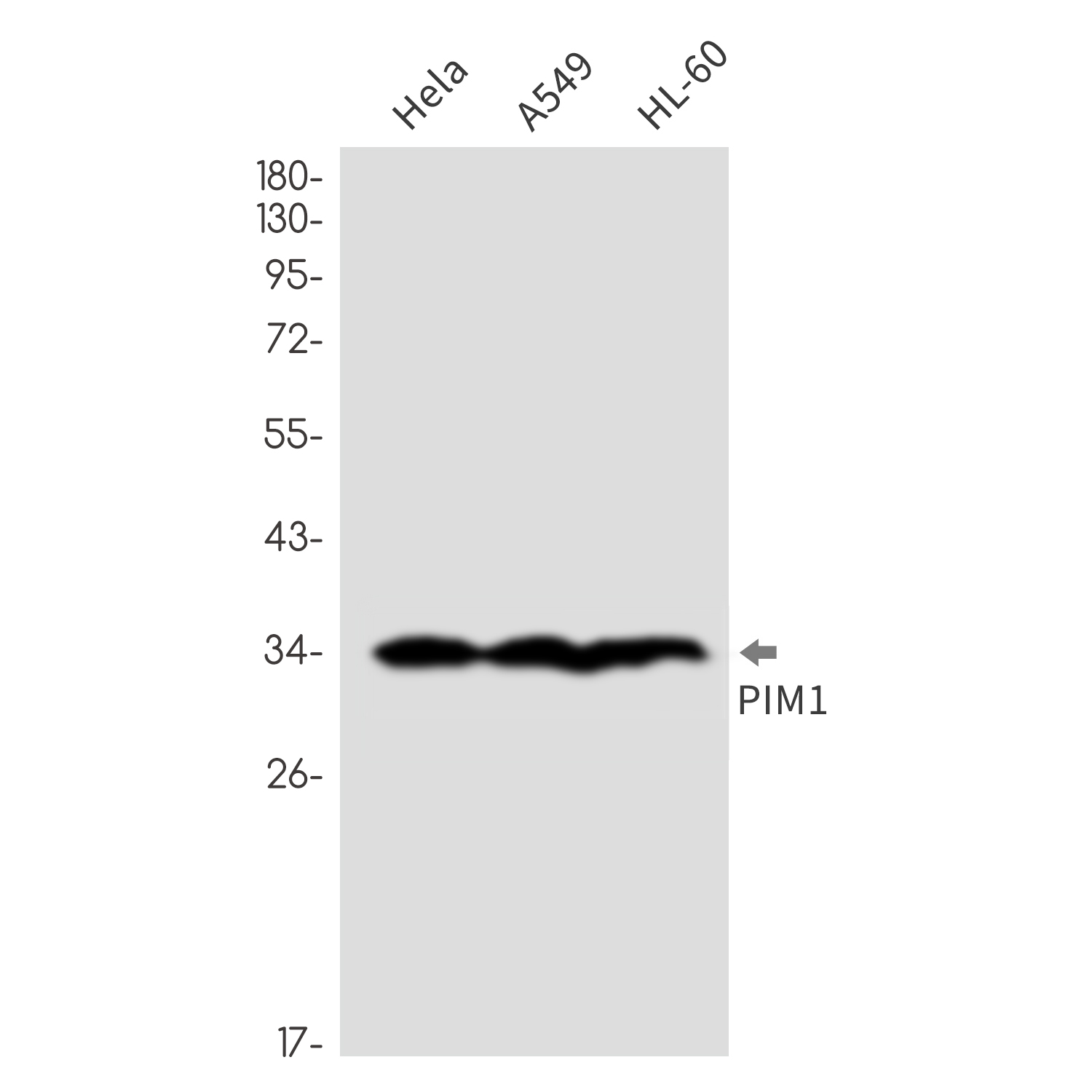 1 - PIM1 Rabbit mAb AP76297