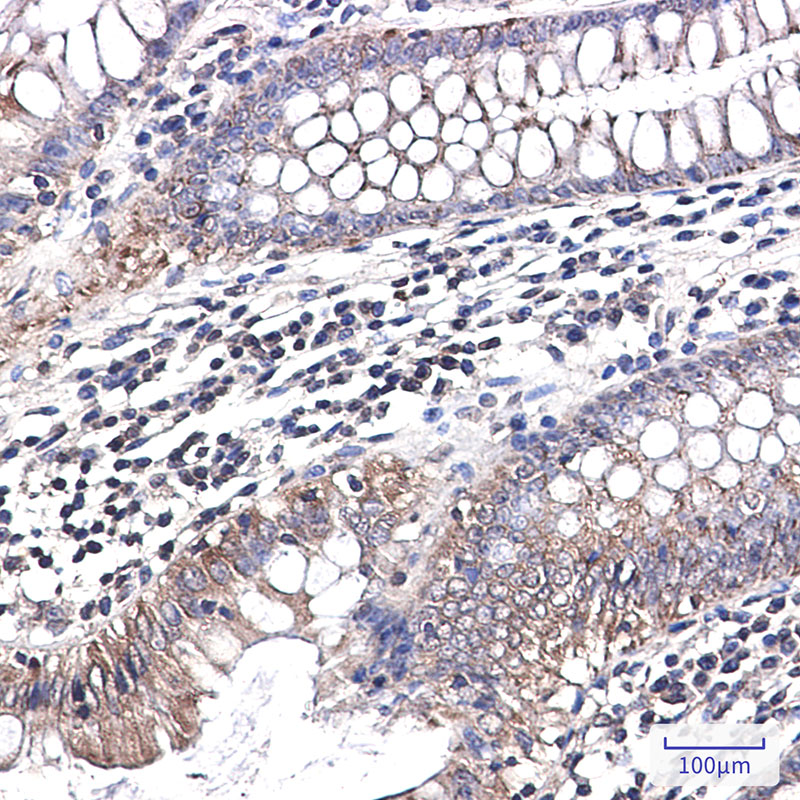 2 - [KO]NDUFB1 Rabbit mAb AP76298