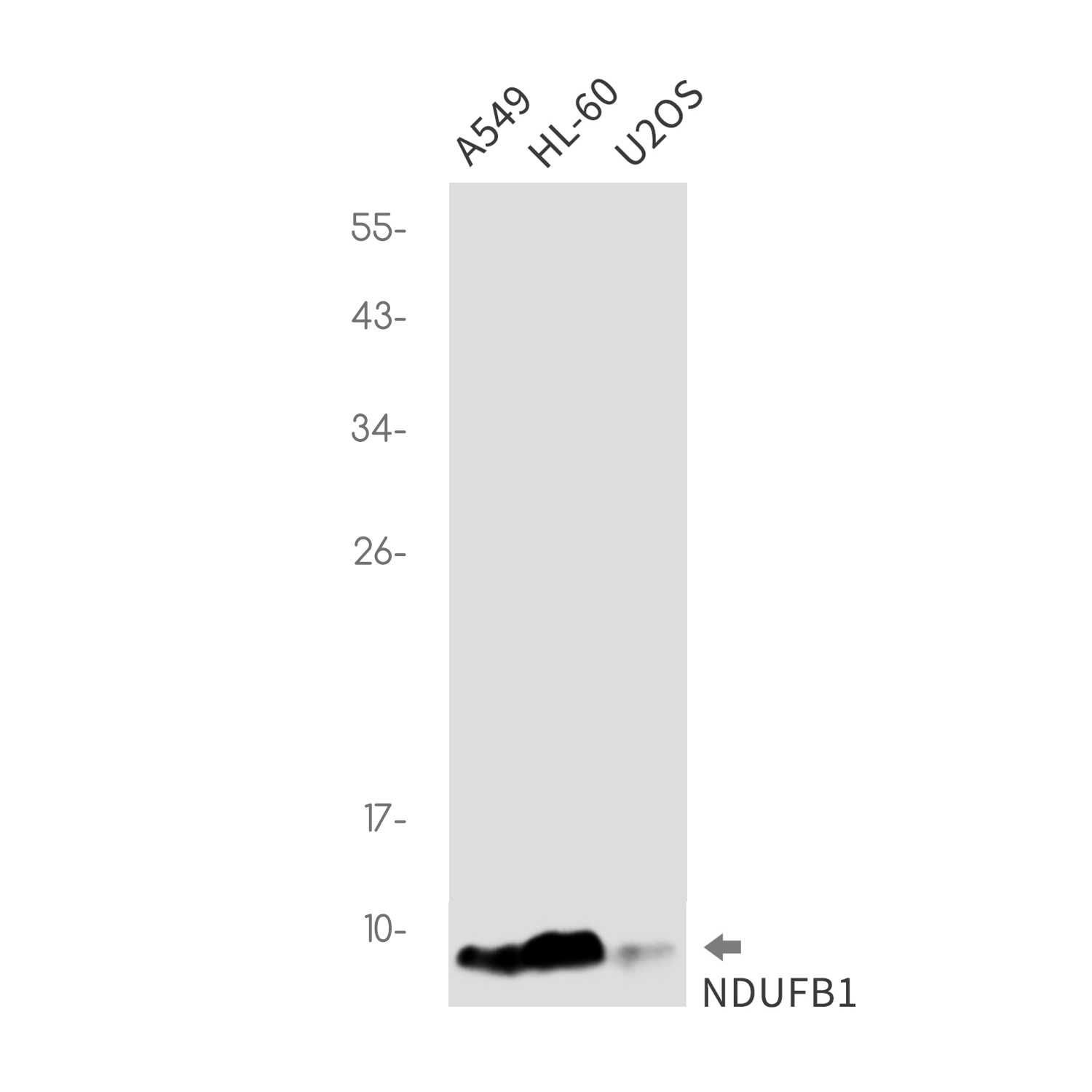 1 - [KO]NDUFB1 Rabbit mAb AP76298