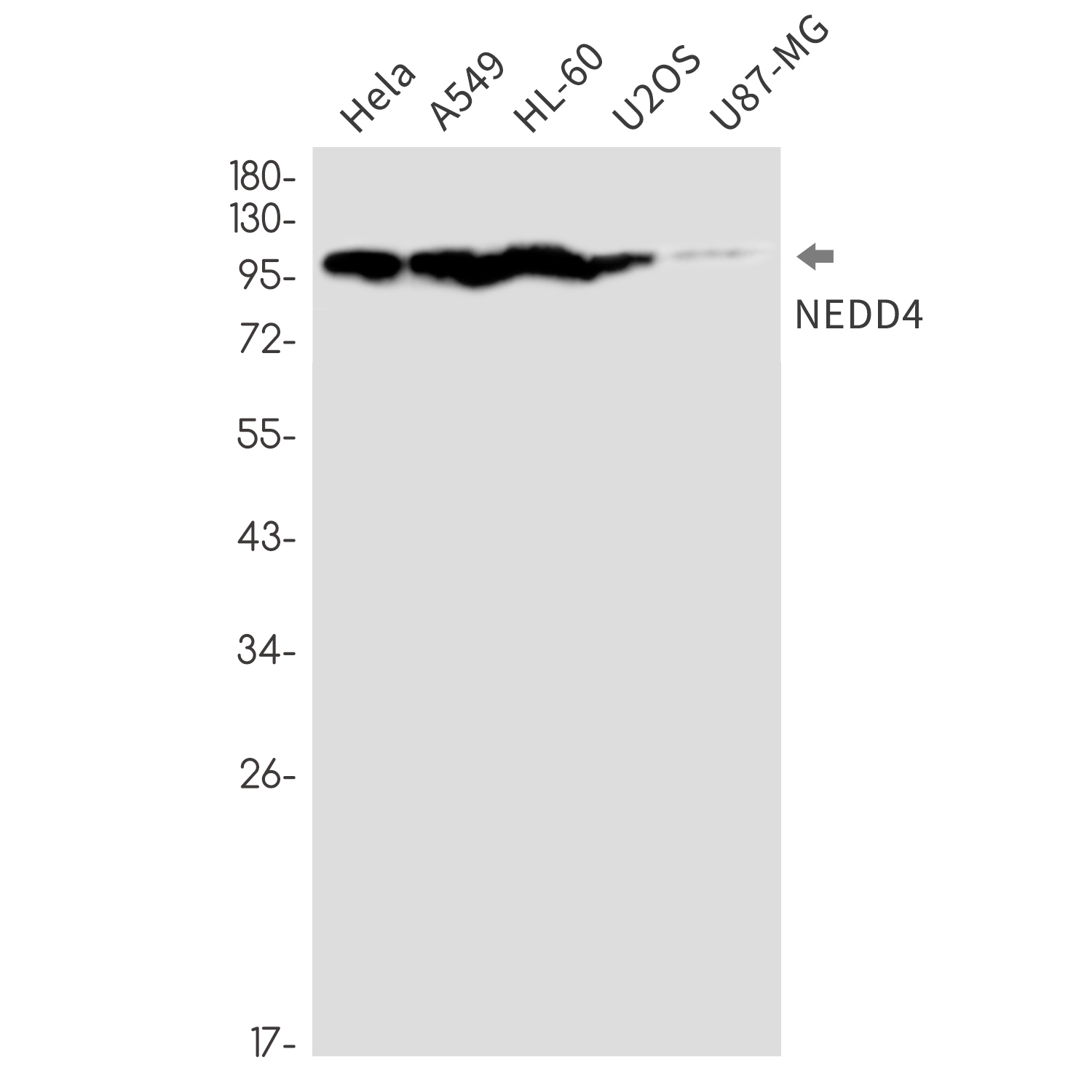 4 - NEDD4 Rabbit mAb AP76300
