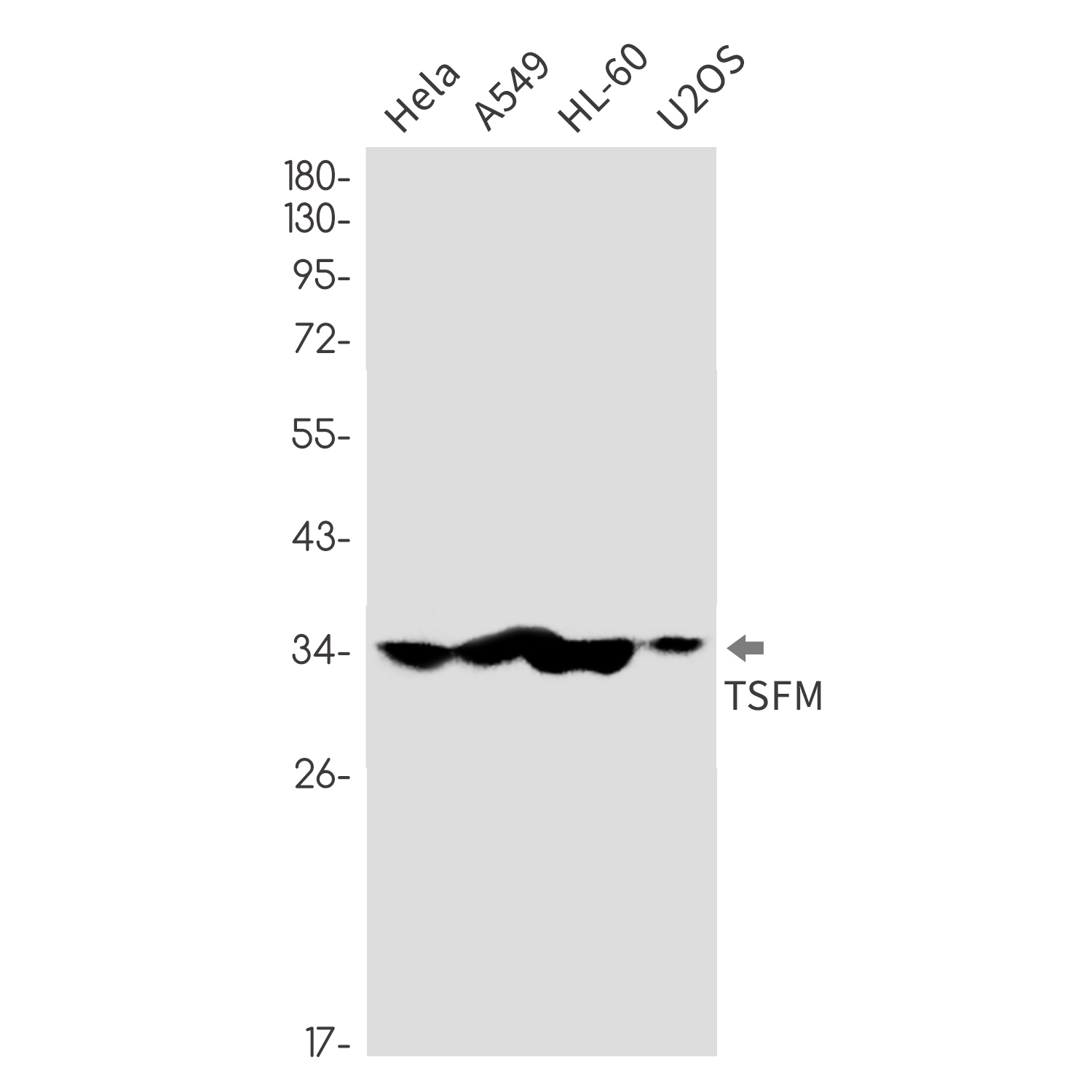 1 - Elongation Factor Ts Rabbit mAb AP76305