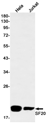1 - SF20 Rabbit mAb AP76306