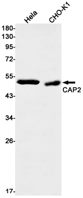 1 - [KD]CAP2 Rabbit mAb AP76308