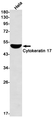 1 - Cytokeratin 17 Rabbit mAb AP76309