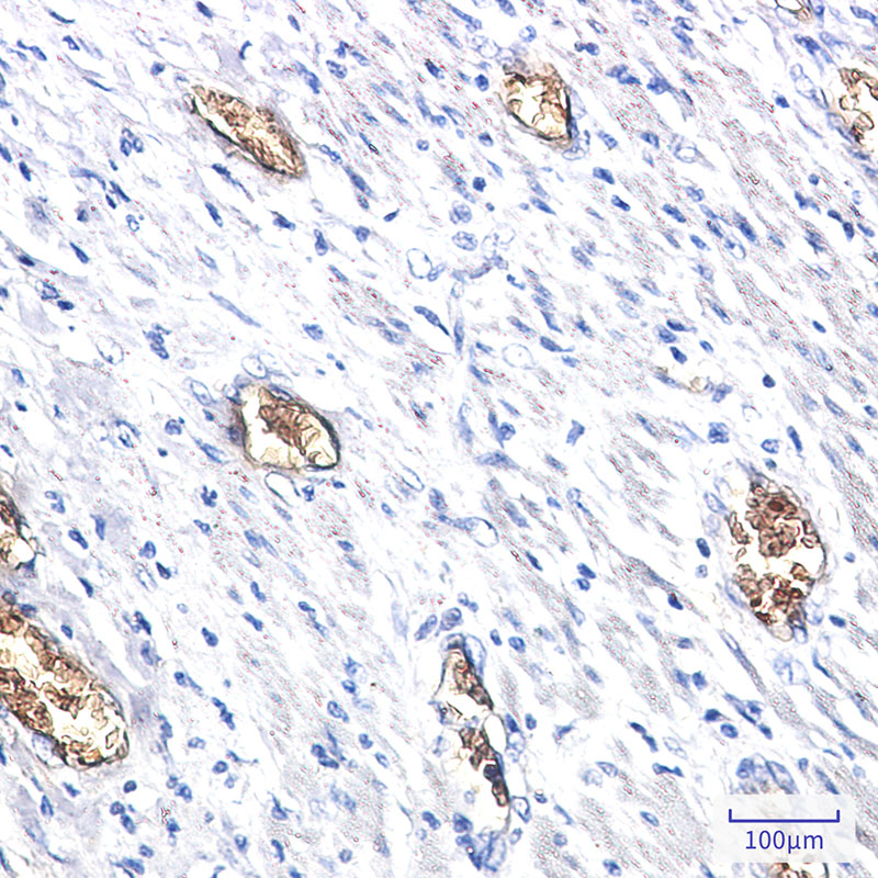 2 - PACSIN3 Rabbit mAb AP76312