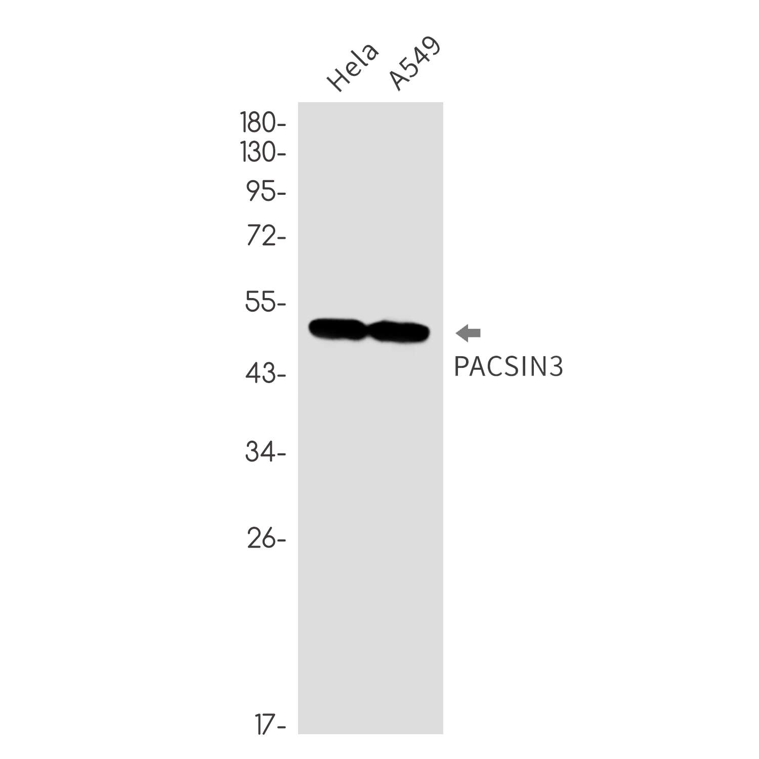 1 - PACSIN3 Rabbit mAb AP76312