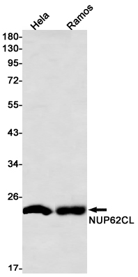 1 - NUP62CL Rabbit mAb AP76313