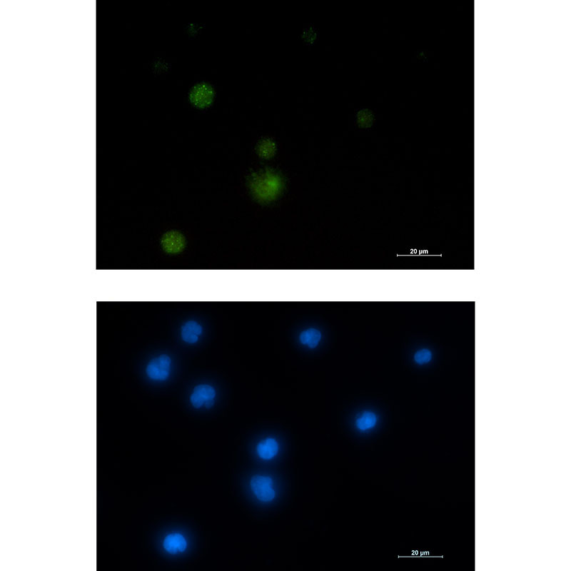 1 - [KO]E1B AP5 Rabbit mAb AP76315