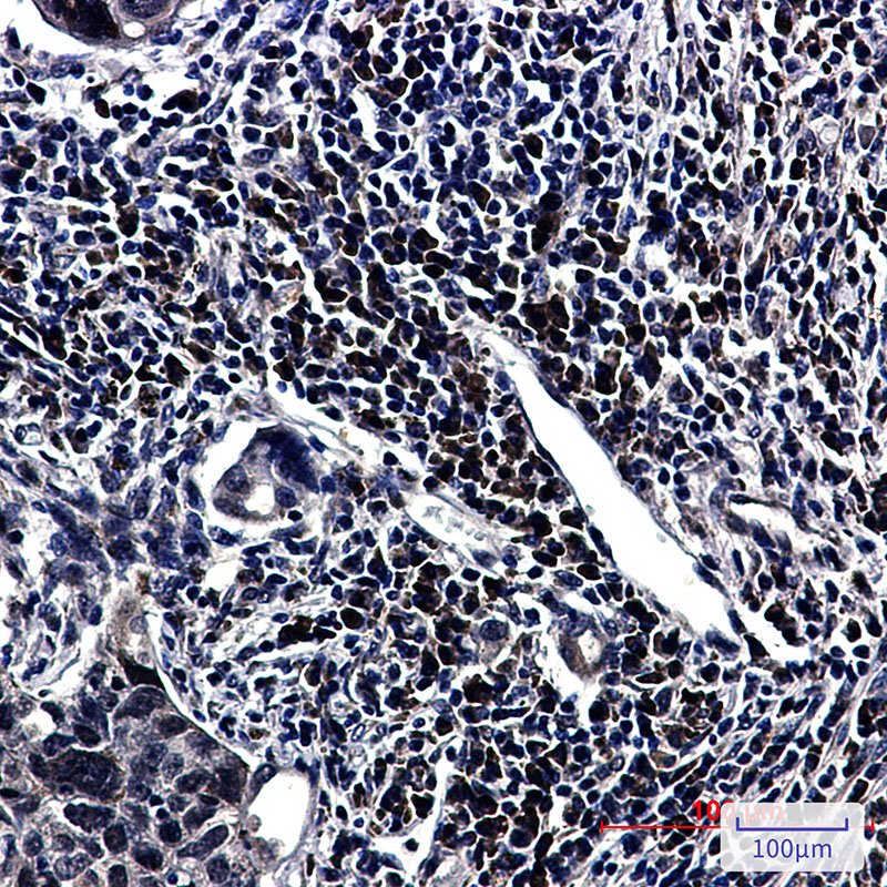8 - [KO]E1B AP5 Rabbit mAb AP76315