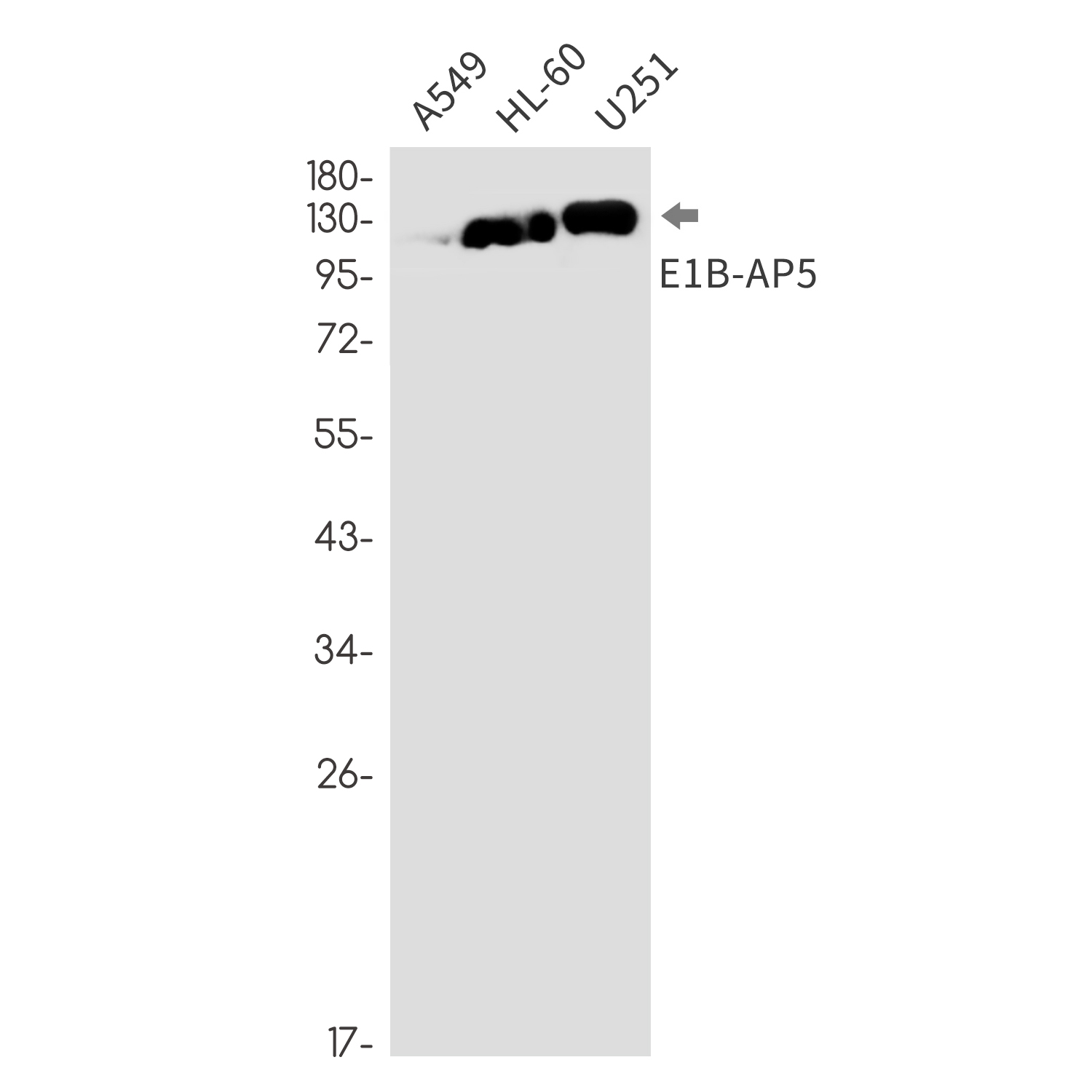 2 - [KO]E1B AP5 Rabbit mAb AP76315