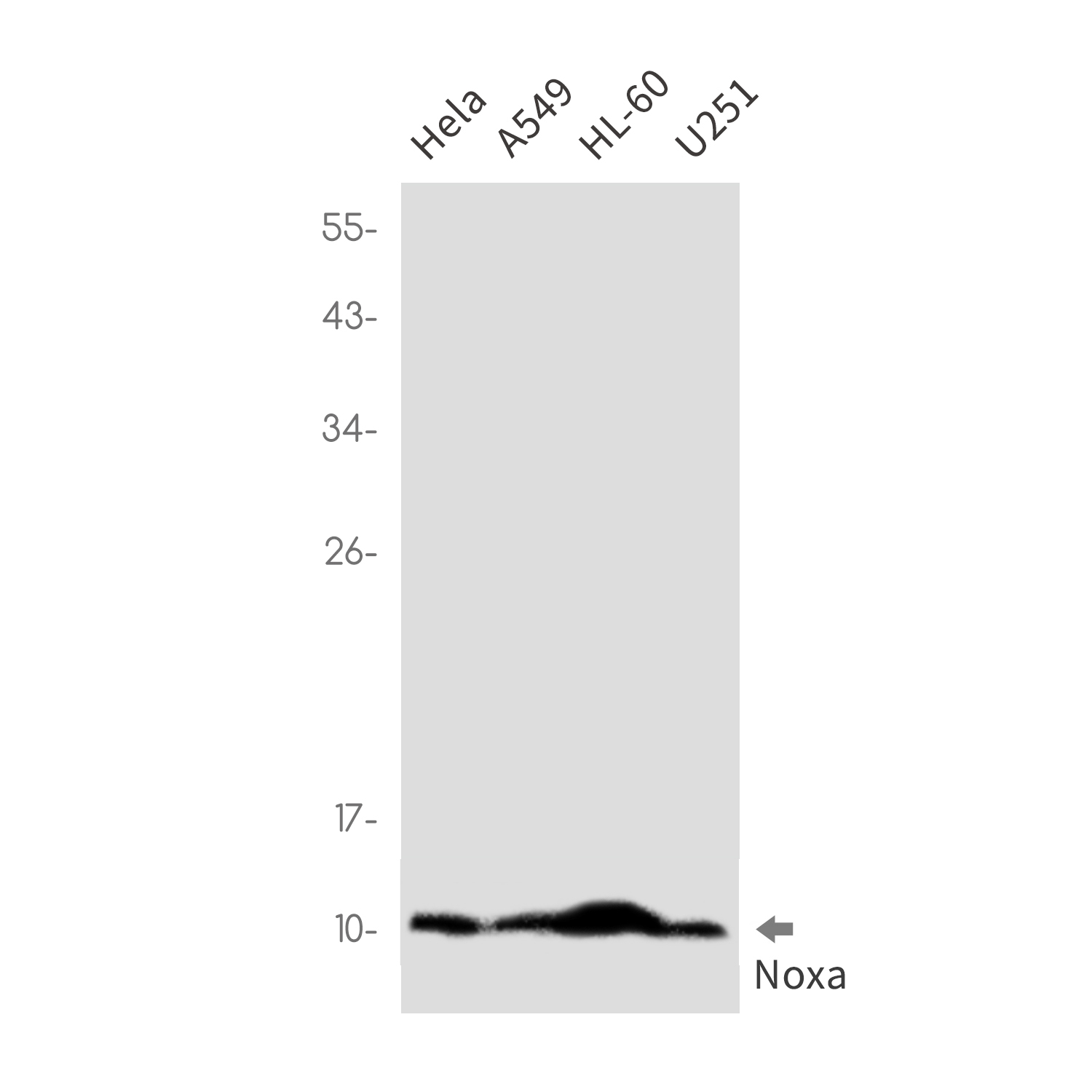 1 - NOXA Rabbit mAb AP76316