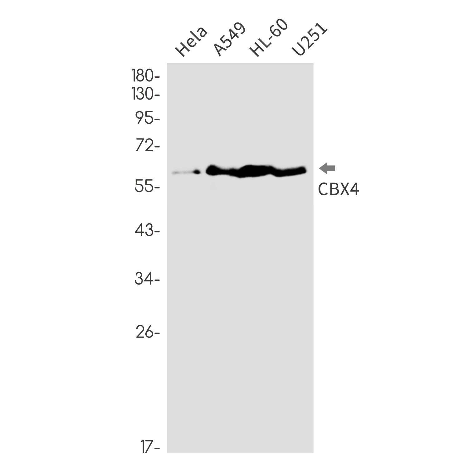 0 - CBX4 Rabbit mAb AP76317