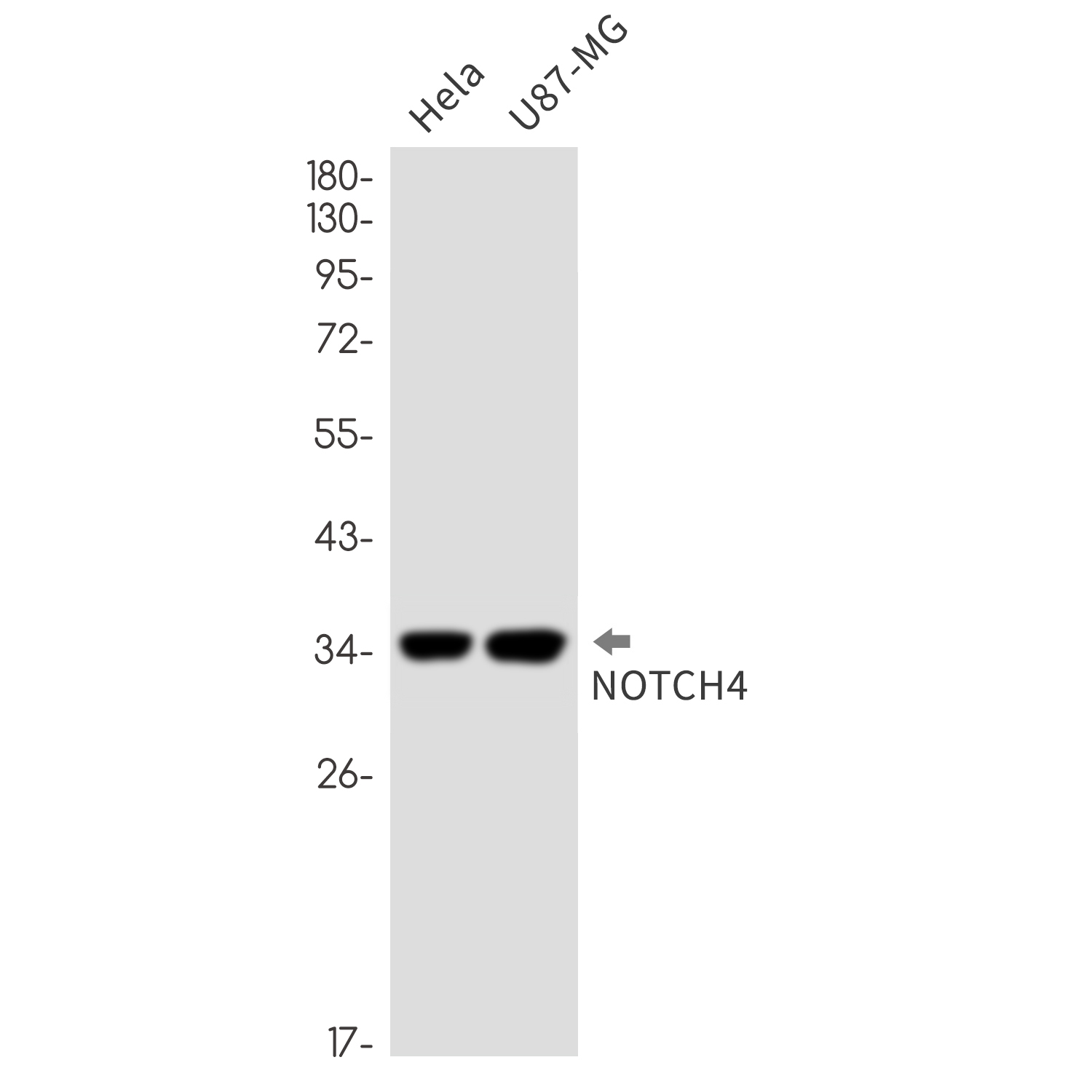 1 - NOTCH4 Rabbit mAb AP76318