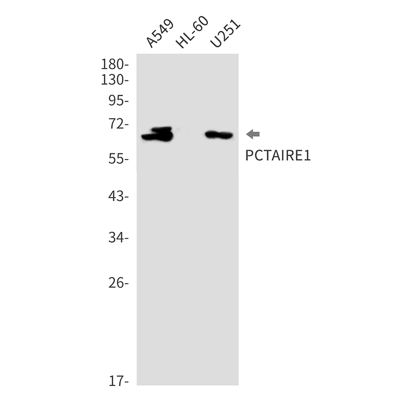 1 - CDK16 Rabbit mAb AP76319