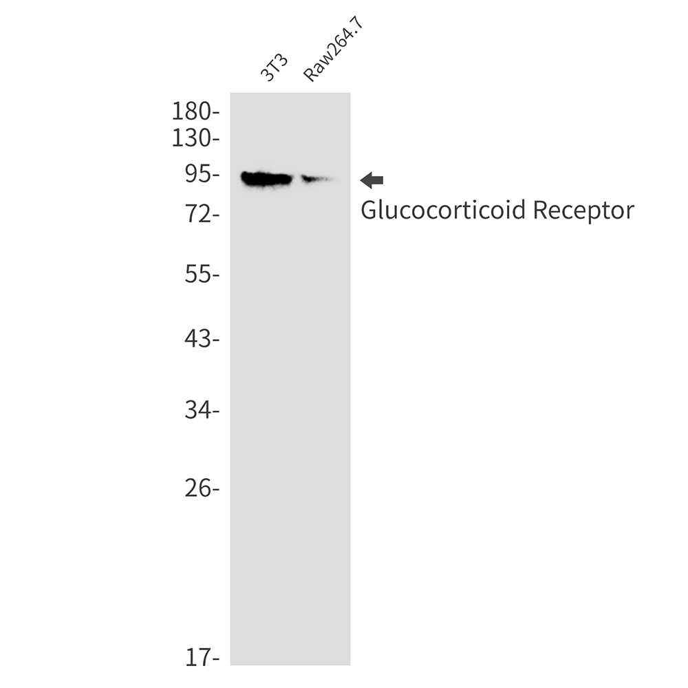 1 - Glucocorticoid Receptor Rabbit mAb AP76320