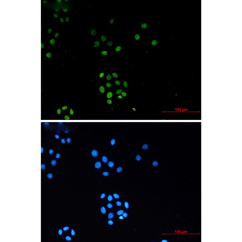 2 - TriMethyl-Histone H3 (Lys27) Rabbit mAb AP76321