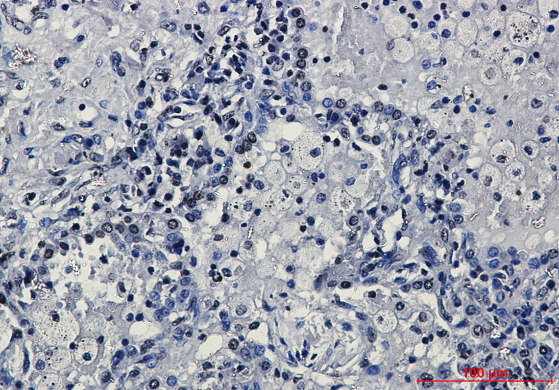 8 - TriMethyl-Histone H3 (Lys27) Rabbit mAb AP76321