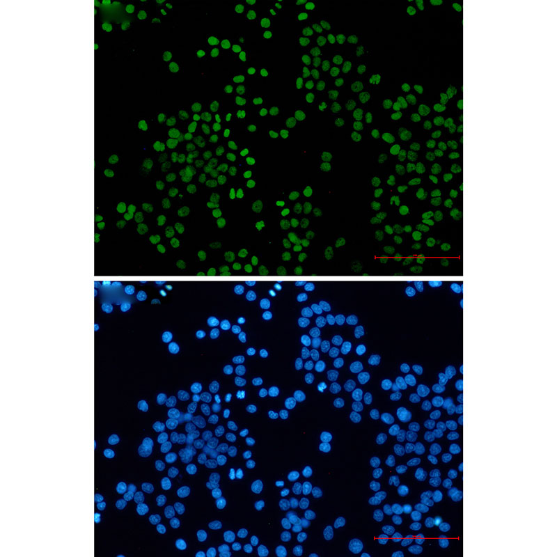 8 - Acetyl-Histone H3 (Lys27) Rabbit mAb AP76322