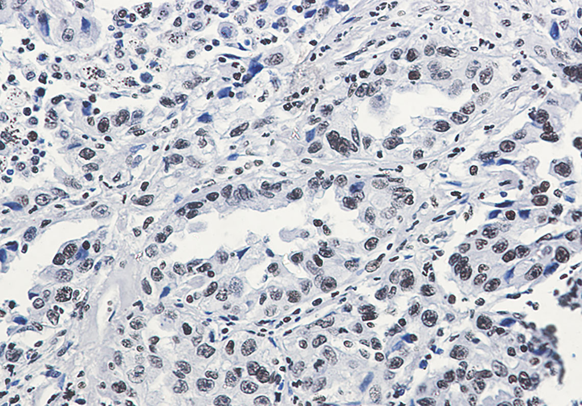 2 - Acetyl-Histone H3 (Lys27) Rabbit mAb AP76322