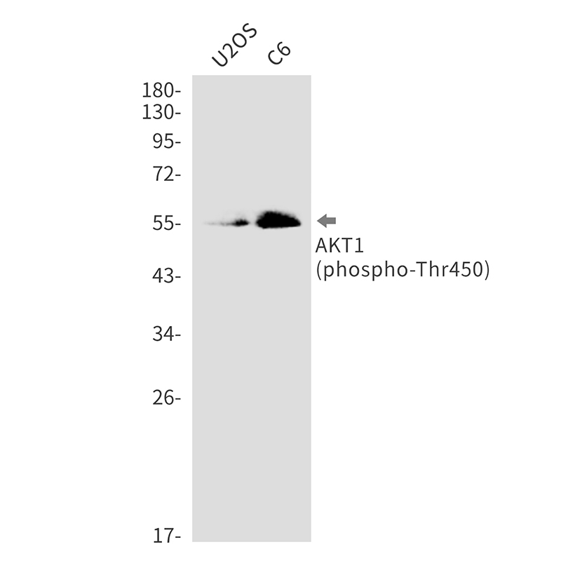 1 - Phospho-AKT1 (Thr450) Rabbit mAb AP76323