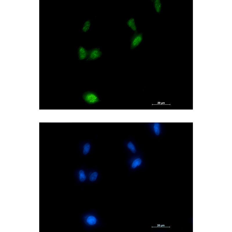 1 - Phospho-Amyloid Precursor Protein (Thr743)  Rabbit mAb AP76325