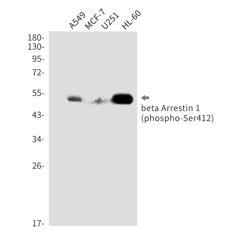 1 - Phospho-beta Arrestin 1 (Ser412) Rabbit mAb AP76326