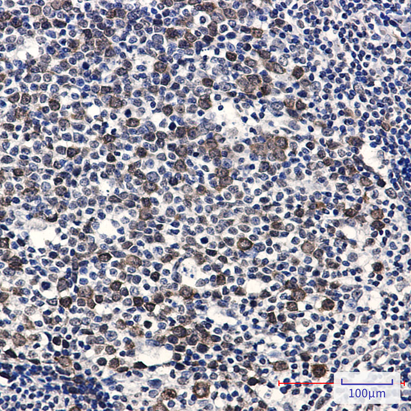 2 - Phospho-CDK2 (Thr14) Rabbit mAb AP76329