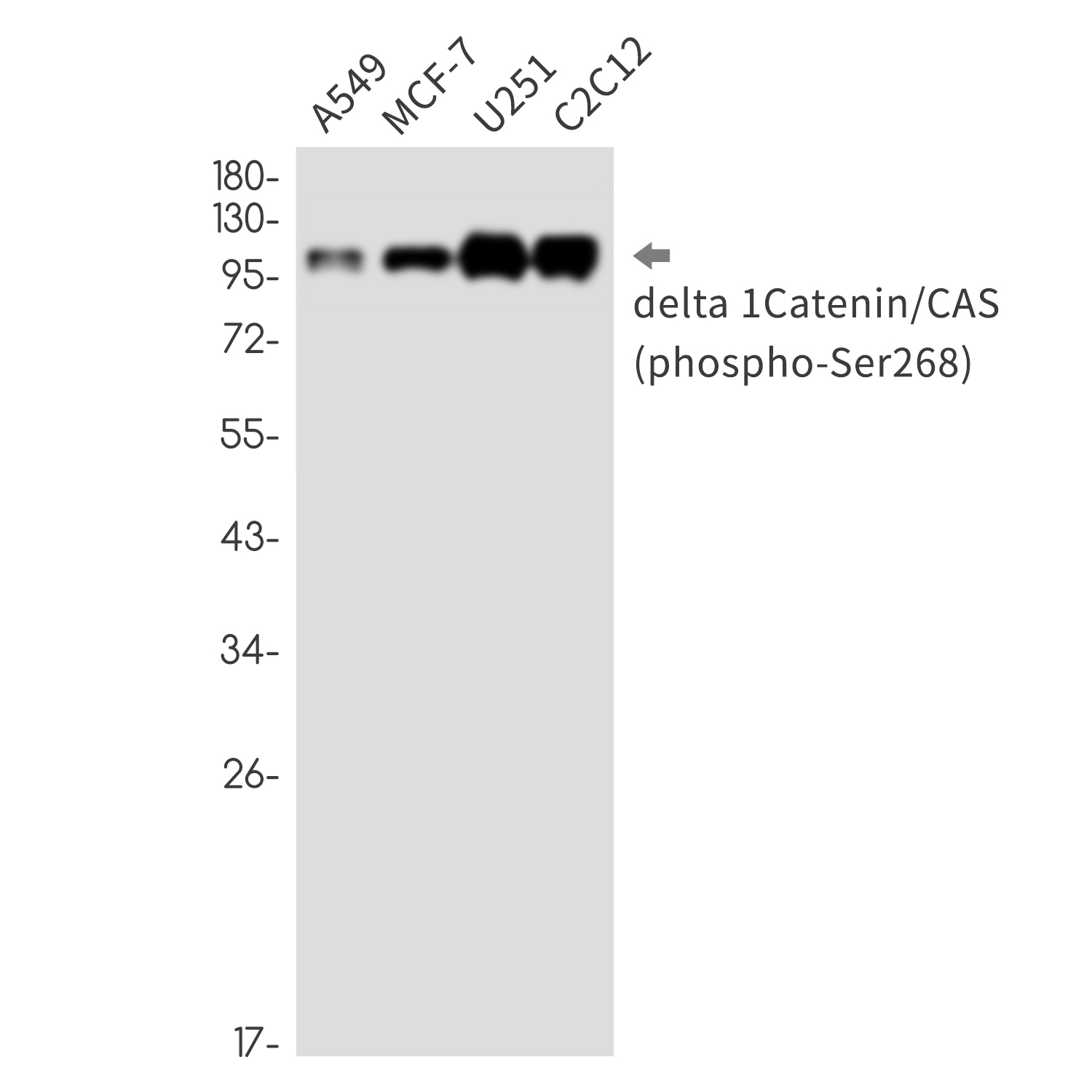 1 - Phospho-delta 1 Catenin (Ser268) Rabbit mAb AP76331