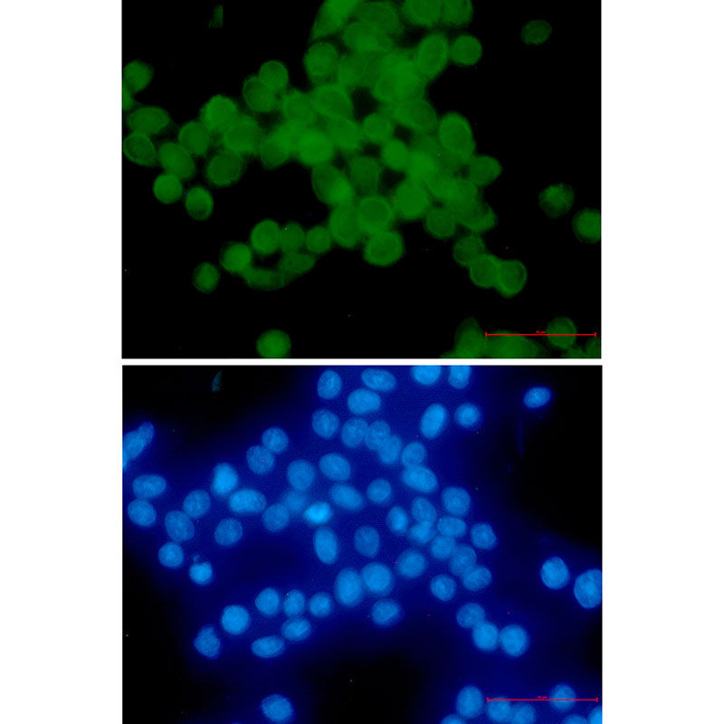 2 - Phospho-delta 1 Catenin (Thr916) Rabbit mAb AP76332