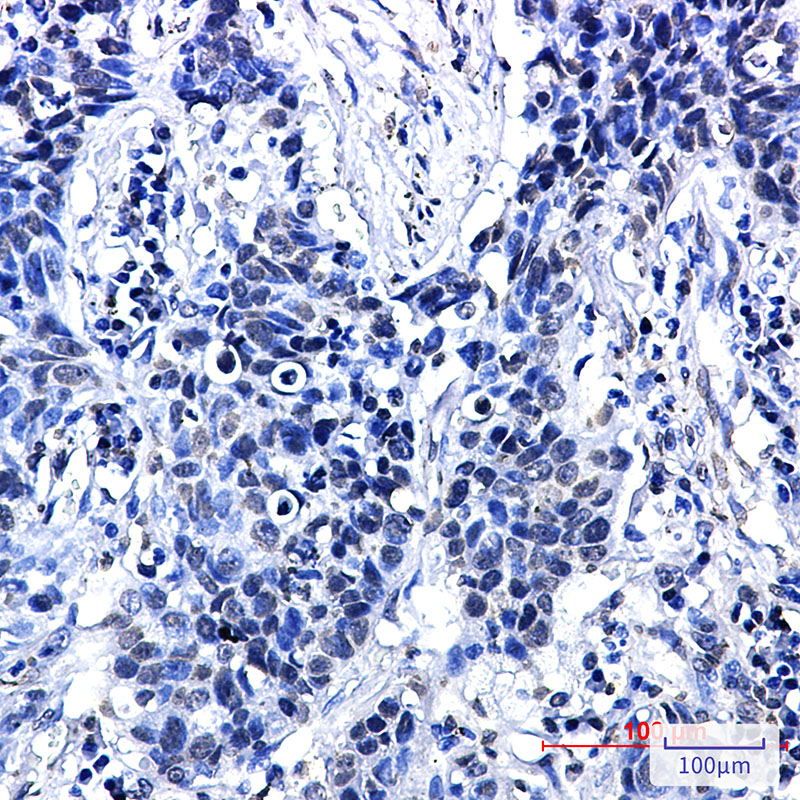 8 - Phospho-delta 1 Catenin (Thr916) Rabbit mAb AP76332