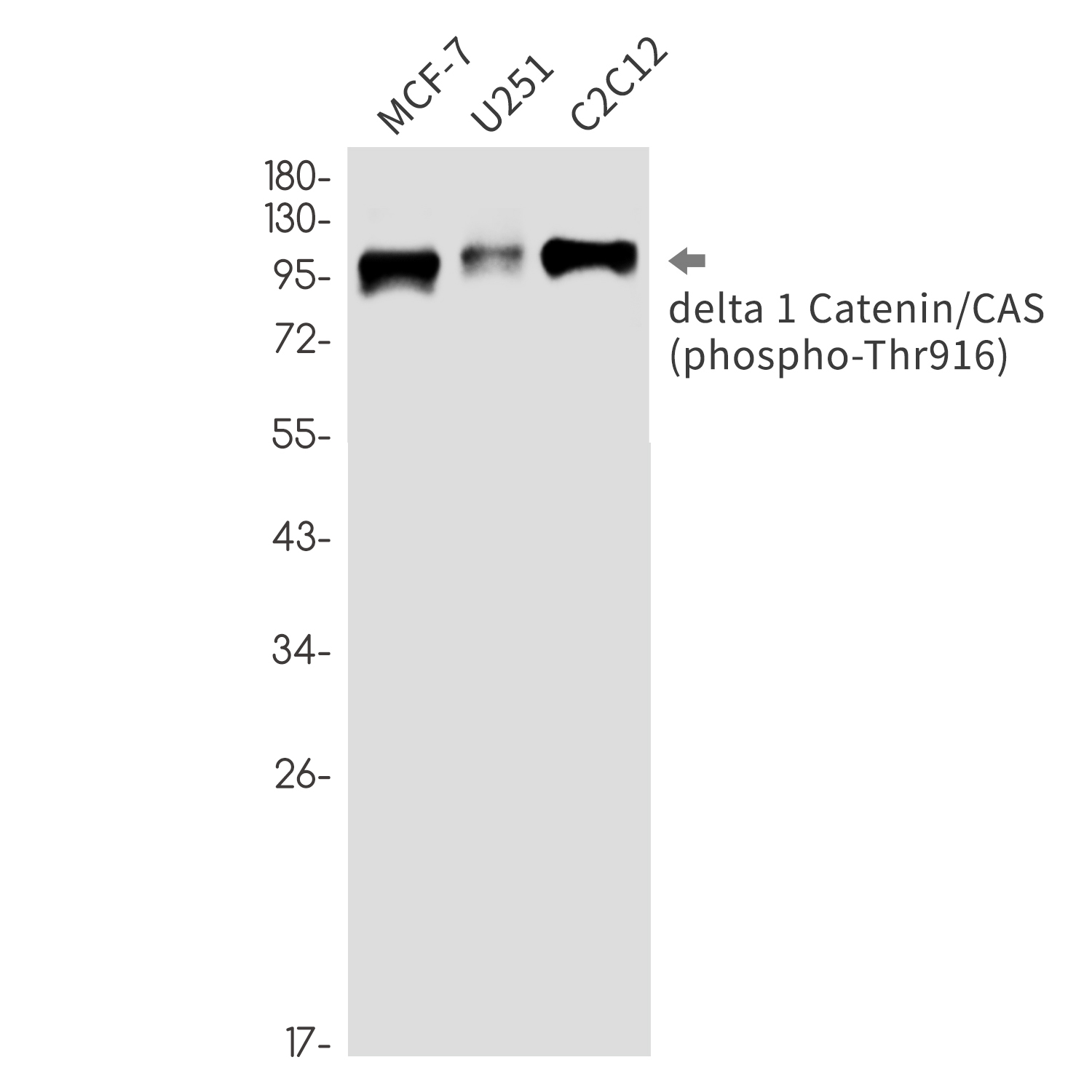 1 - Phospho-delta 1 Catenin (Thr916) Rabbit mAb AP76332