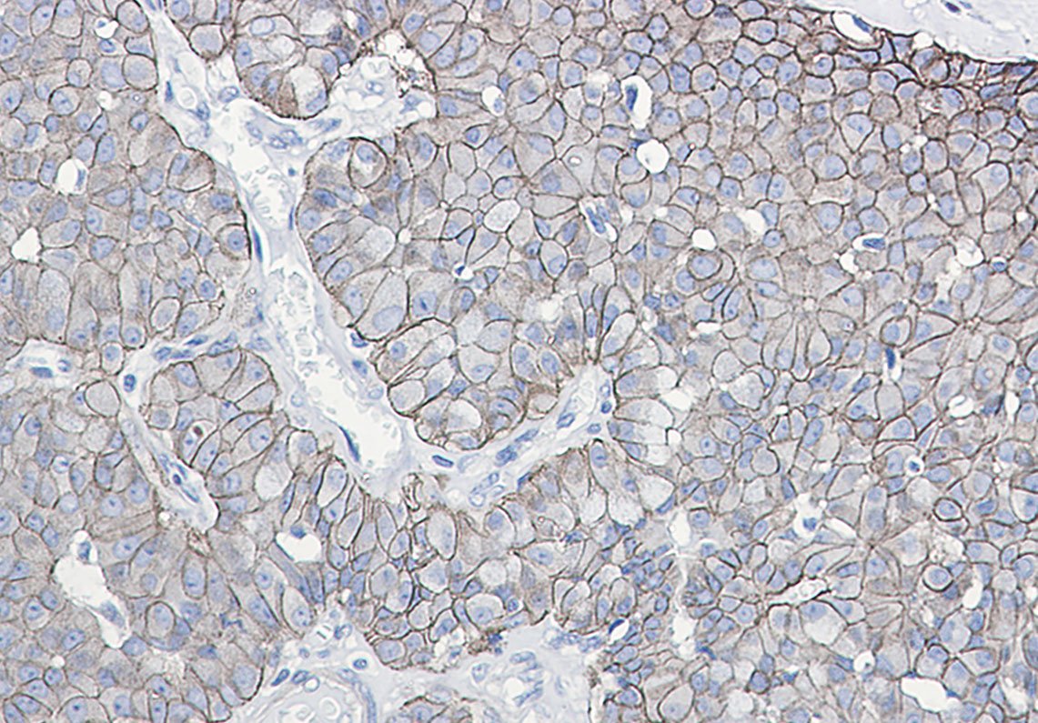 0 - Phospho-E Cadherin (Ser838/Ser840) Rabbit mAb AP76333