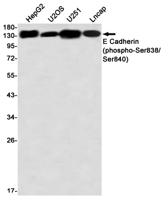 2 - Phospho-E Cadherin (Ser838/Ser840) Rabbit mAb AP76333