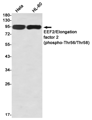 1 - Phospho-EEF2/Elongation factor 2 (Thr56/Thr58) Rabbit mAb AP76334