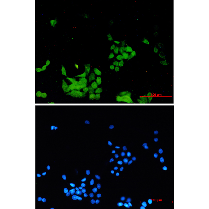 4 - Phospho-EGFR (Tyr1173) Rabbit mAb AP76335