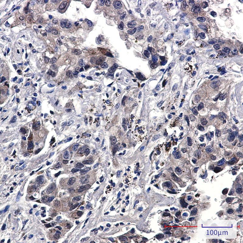 8 - Phospho-EGFR (Tyr1173) Rabbit mAb AP76335