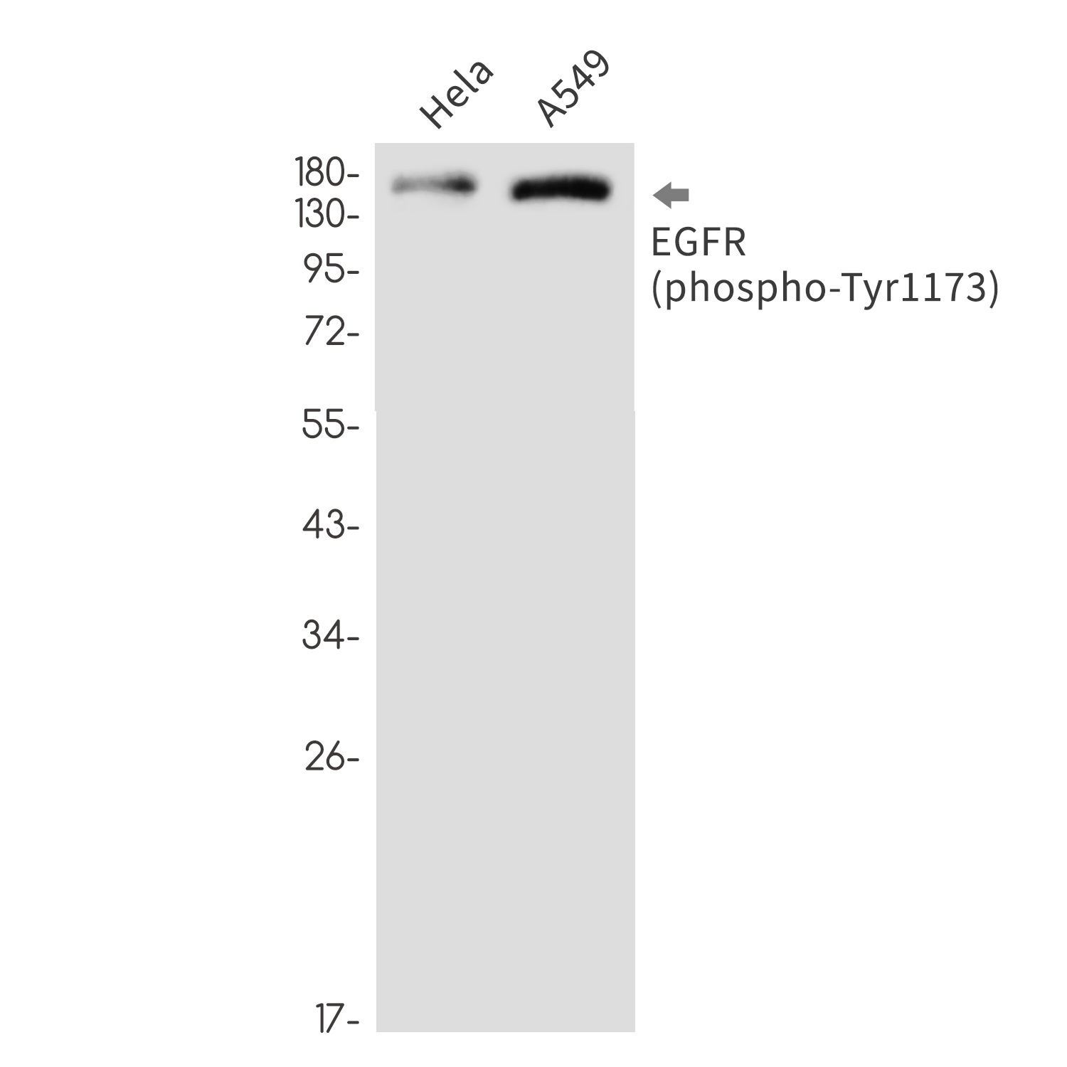 1 - Phospho-EGFR (Tyr1173) Rabbit mAb AP76335