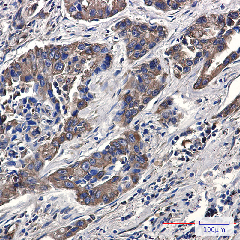 0 - Phospho-eIF4B (Ser406) Rabbit mAb AP76336
