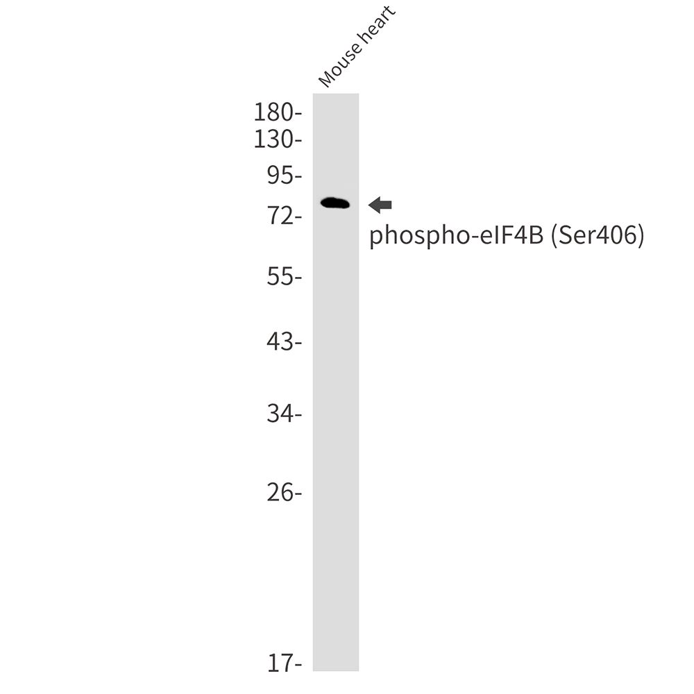 1 - Phospho-eIF4B (Ser406) Rabbit mAb AP76336