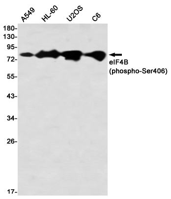 2 - Phospho-eIF4B (Ser406) Rabbit mAb AP76336