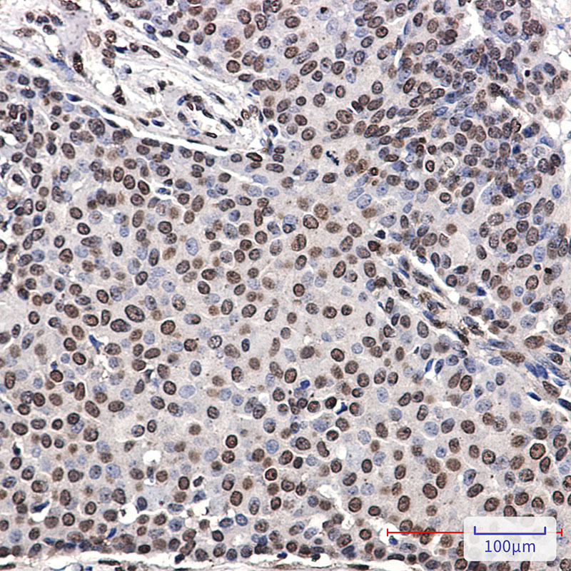 2 - Phospho-ErbB 4 (Tyr1162) Rabbit mAb AP76337