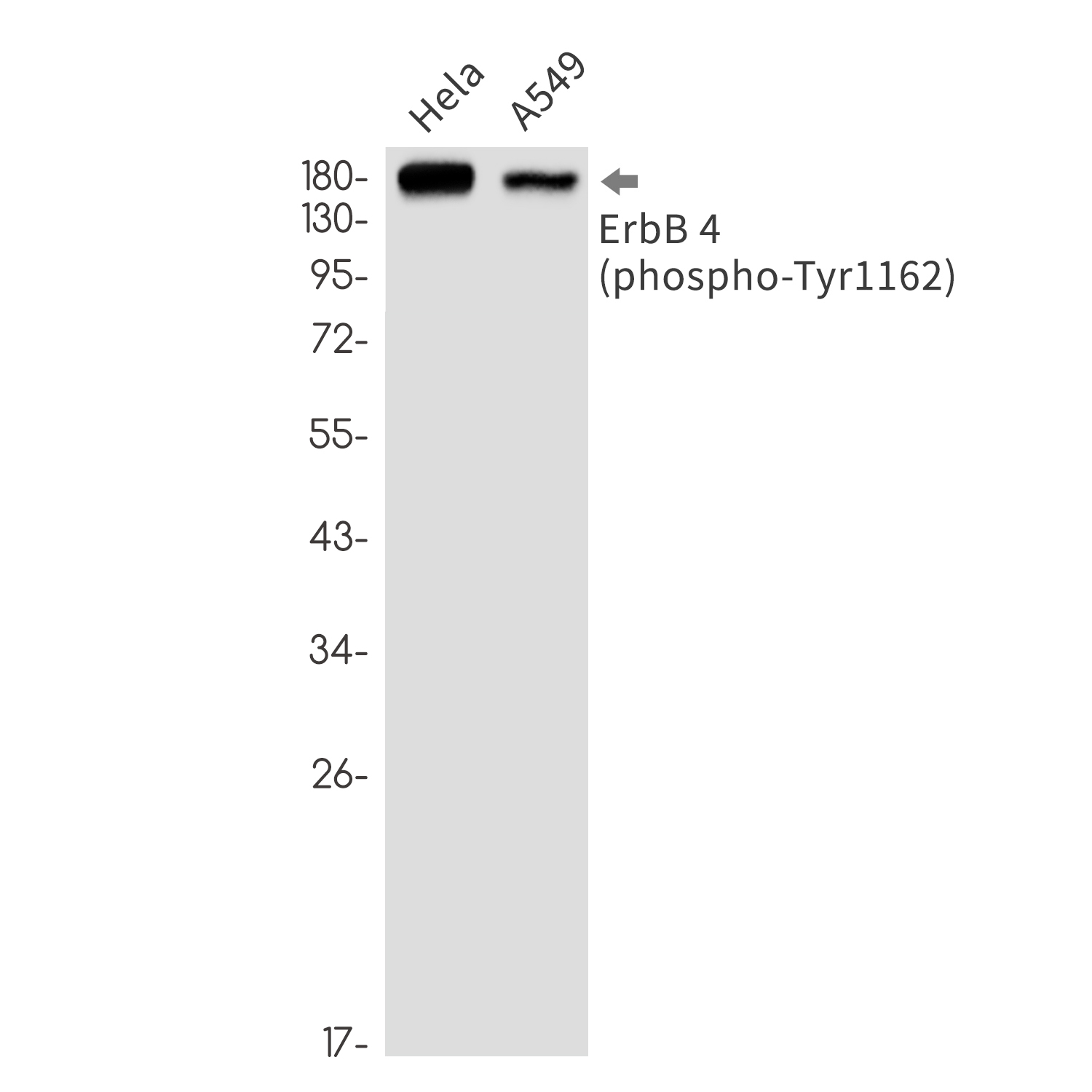 1 - Phospho-ErbB 4 (Tyr1162) Rabbit mAb AP76337