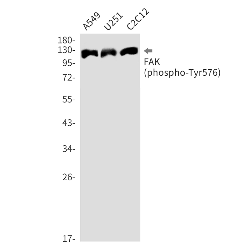 1 - Phospho-FAK (Tyr576) Rabbit mAb AP76339