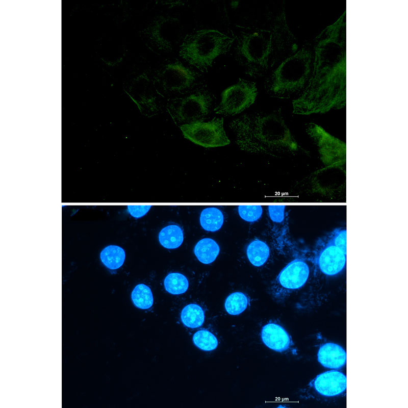 1 - Phospho-Filamin A/B (Ser2152/Ser2107) Rabbit mAb AP76340
