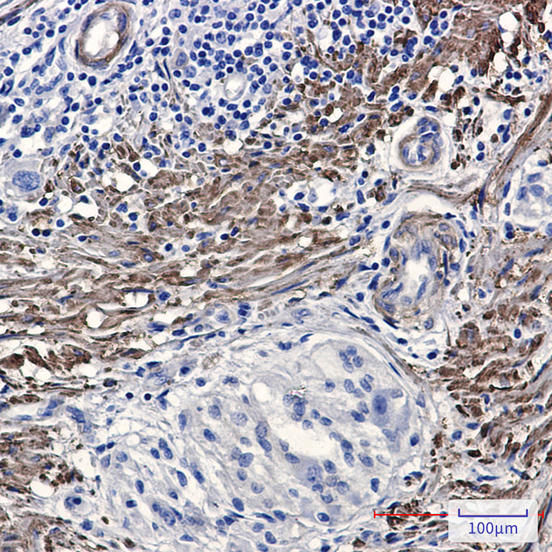 8 - Phospho-Filamin A/B (Ser2152/Ser2107) Rabbit mAb AP76340
