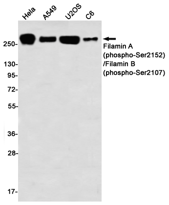 2 - Phospho-Filamin A/B (Ser2152/Ser2107) Rabbit mAb AP76340