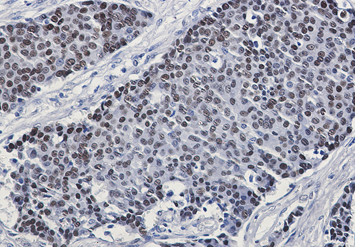 2 - Phospho-GATA3 (Ser308) Rabbit mAb AP76341