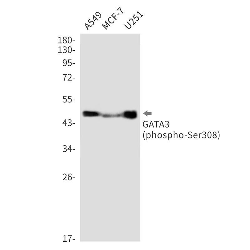 1 - Phospho-GATA3 (Ser308) Rabbit mAb AP76341