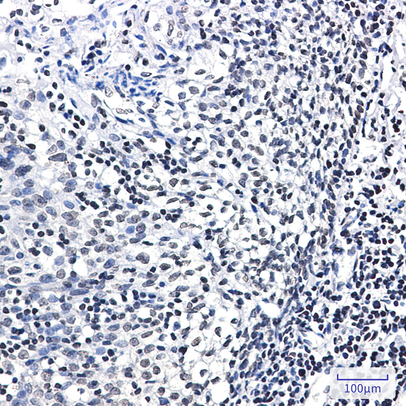 2 - Phospho-Glucocorticoid Receptor (Ser226) Rabbit mAb AP76342