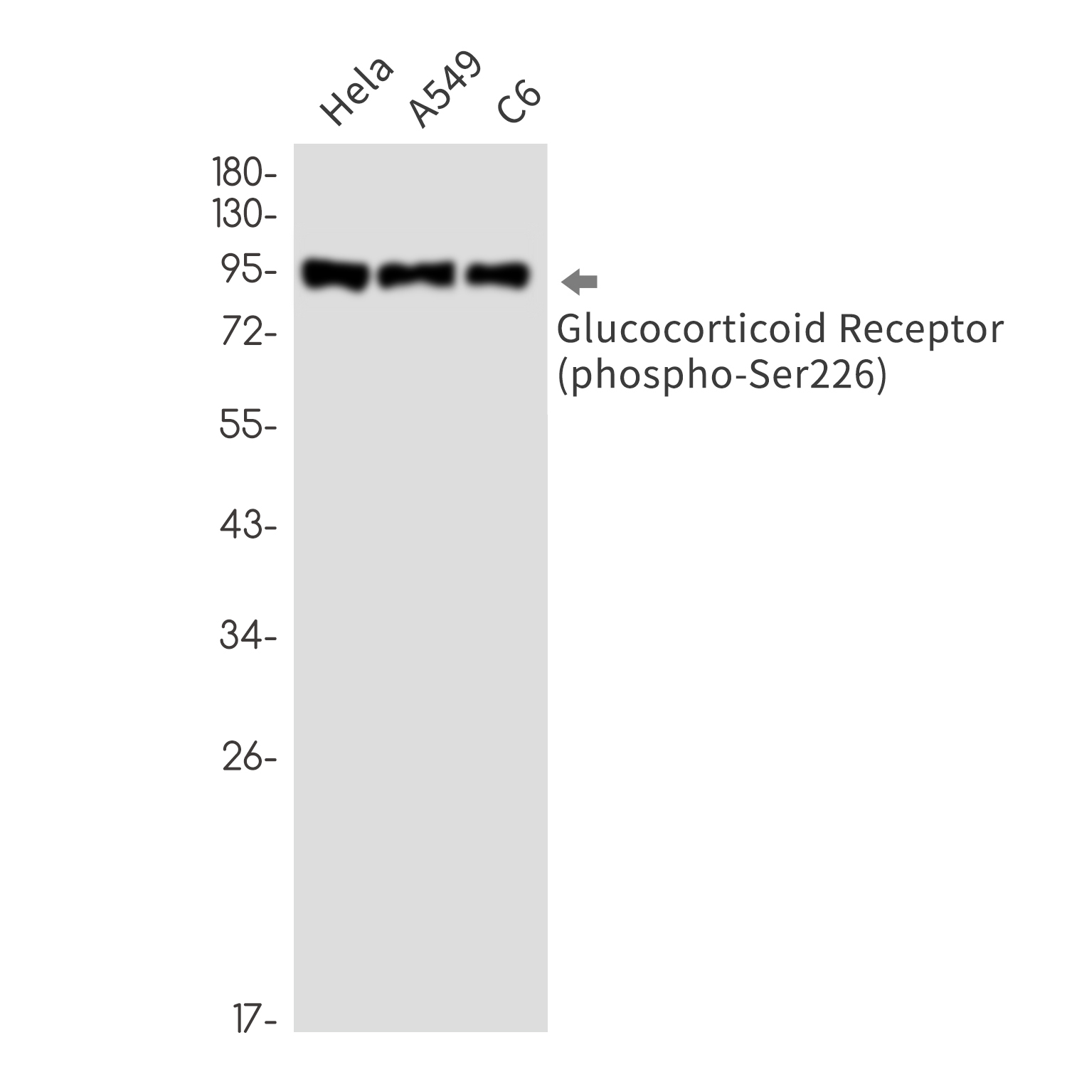 1 - Phospho-Glucocorticoid Receptor (Ser226) Rabbit mAb AP76342